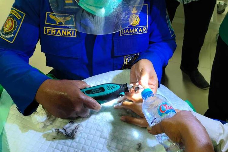 Iseng, Remaja di Ponorogo Pasang Mur Baja di Jari, Berakhir Dilepaskan Damkar