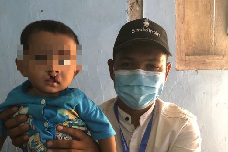 Caption:

Pekerja sosial di Yayasan Smile Train Indonesia di Aceh, Rahmad Maulizar, 29, berfoto bersama salah seorang anak penderita bibir sumbing yang akan diikutkan dalam program operasi grastis. Foto diambil belum lama ini.
