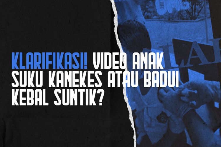 KLARIFIKASI! Video Anak Suku Kanekes atau Badui Kebal Suntik?