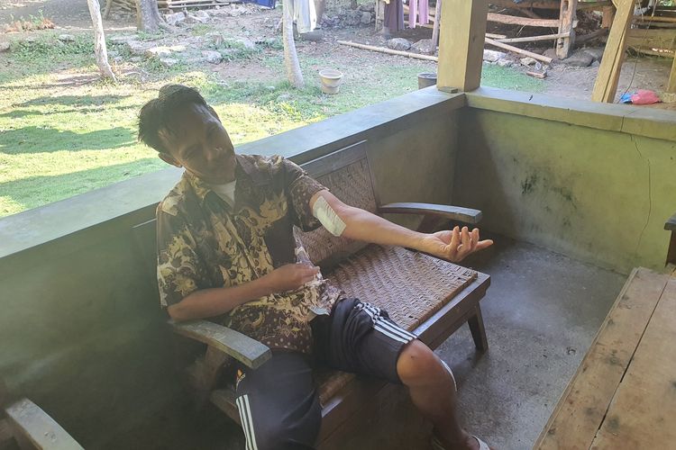 Disebut Monyet Ganteng, Beruk Sumatera yang Lepas di Gunungkidul Serang Anak dan Warga