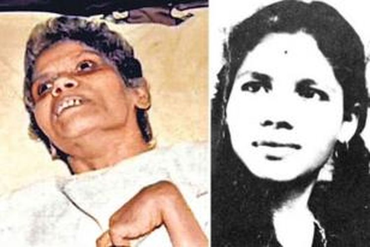 Aruna Shanbaug, koma selama 42 tahun setelah diperkosa saat bekerja di RS King Edward Memorial, Mumbai, India pada 1973.