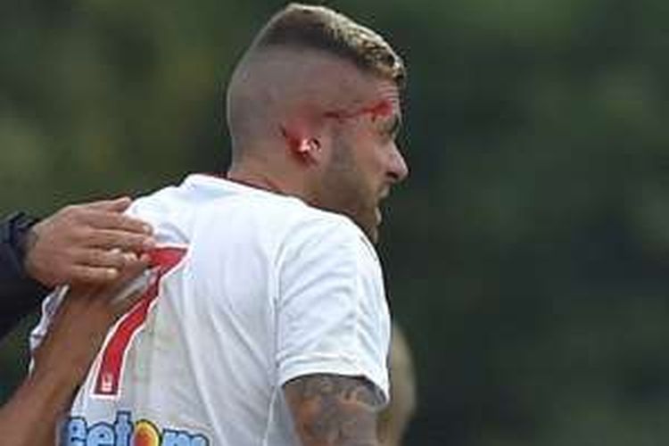 Penyerang anyar Bordeaux, Jeremy Menez, mengalami cedera mengerikan pada laga persahabatan melawan FC Lorient di Stade Le Faouet, Rabu (3/8/2016).  
