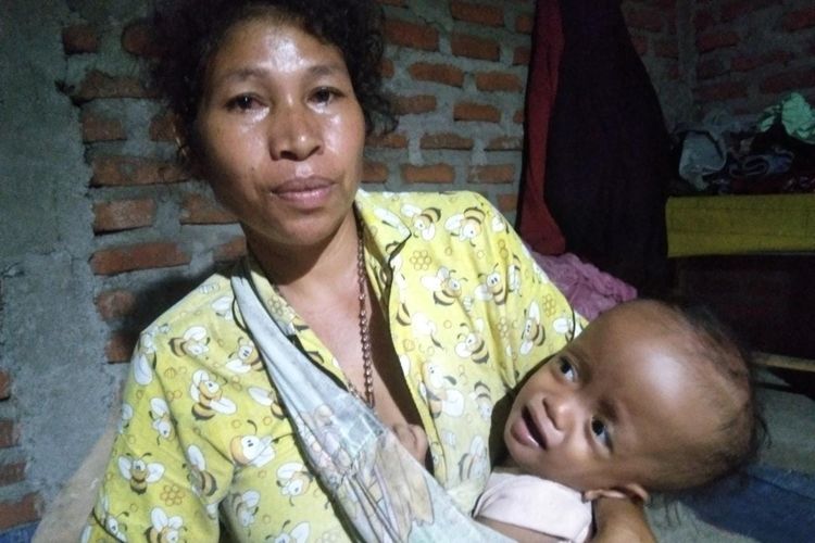 Foto : Maria Novantri Anul, balita yang kini berusia 1 tahun, asal Kampung Golo Karot, Kelurahan Tangge, Kecamatan Lembor, Kabupaten Manggarai Barat, NTT, mengidap penyakit hidrosefalus, dipangku ibundanya, Rofina Nunur. 