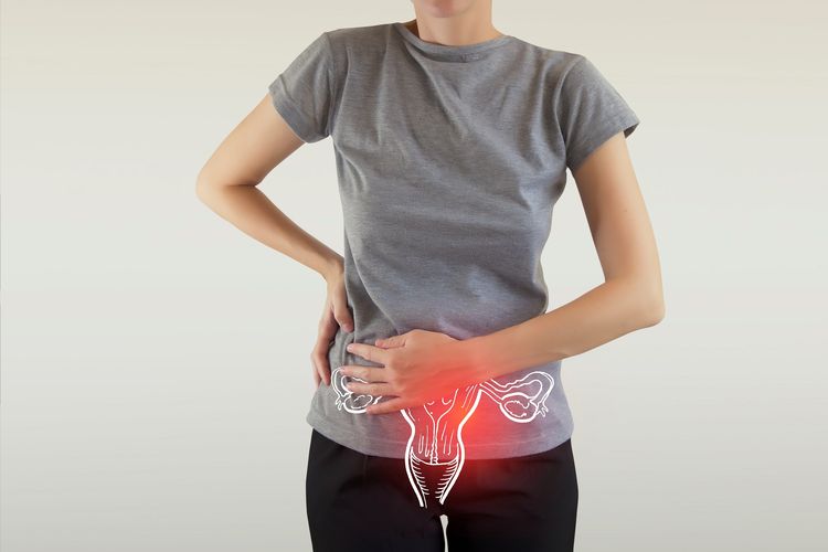 Ilustrasi kista ovarium. Ciri-ciri kista ovarium, kista ovarium dapat menyebabkan sakit perut sebelah kanan bawah pada wanita.