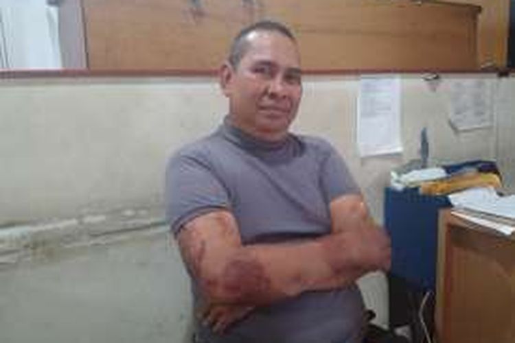 Ipda Denny Mahieu, korban luka ledakan bom di Jalan MH Thamrin pada 14 Januari 2016 lalu.