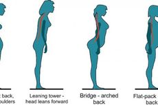 Tipe Postur Tubuh yang Rentan Alami Nyeri Punggung