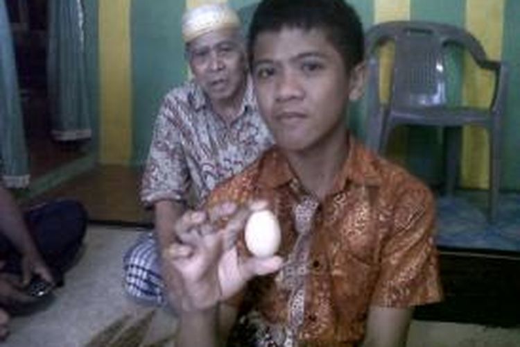Akmal (12), bocah asal Dusun Kampong Beru, Desa Mengempang, Kecamatan Bungaya, Kabupaten Gowa, Sulawesi Selatan tengah memperlihatkan telur ketiga yang keluar dari anusnya sebelum akhirnya dilarikan ke rumah sakit lantaran kembali mengeluarkan telur hingga enam butir. 