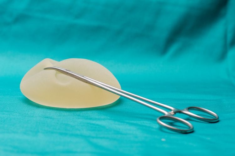 FDA Peringatkan Risiko Kanker akibat Implan Payudara 
