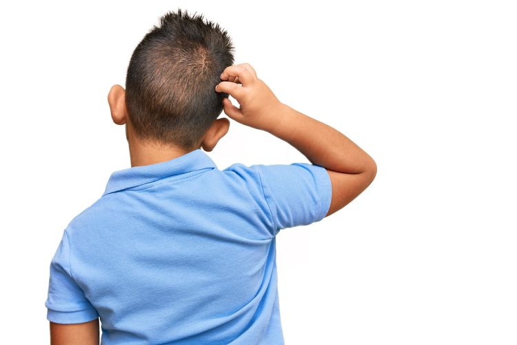 Jangan Panik Anak Kutuan, Ini Cara Menghilangkan Kutu Rambut