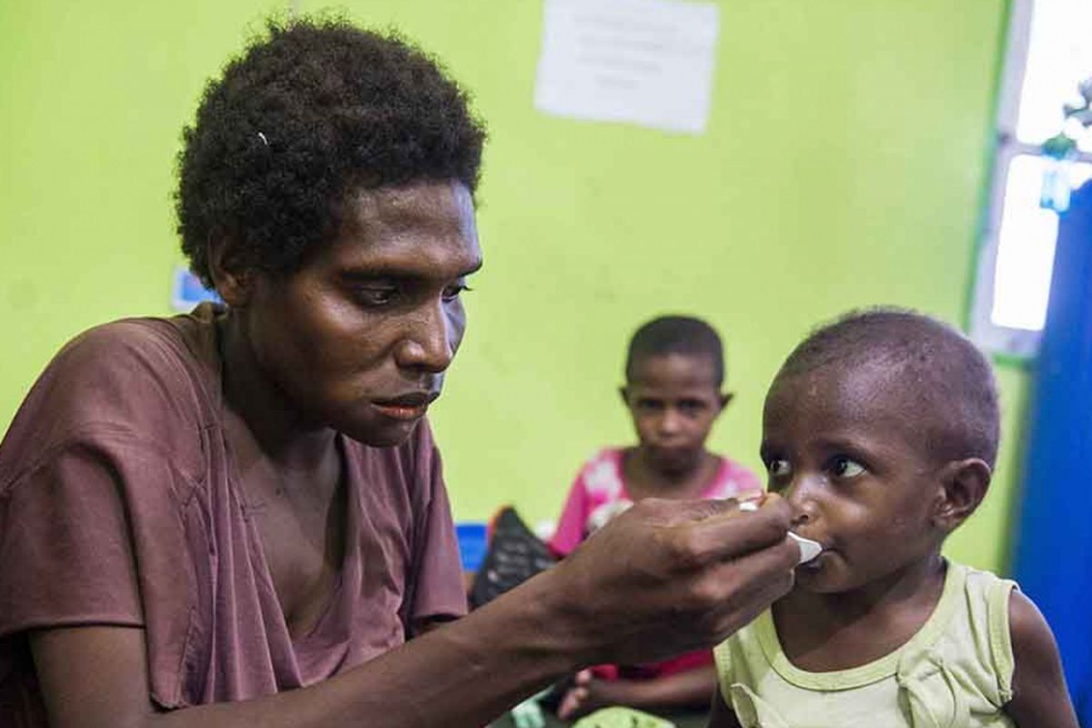 Seorang ibu memberikan susu kepada anaknya di Rumah Sakit Umum Daerah (RSUD) Agats, Kabupaten Asmat, Papua, Sabtu (27/1/2018). Data terakhir jumlah pasien campak dan gizi buruk di RSUD tersebut mencapai 88 dengan rincian penderita campak 7 pasien, gizi buruk 73 pasien, gizi buruk plus campak 2 pasien dan gizi kurang 6 pasien.