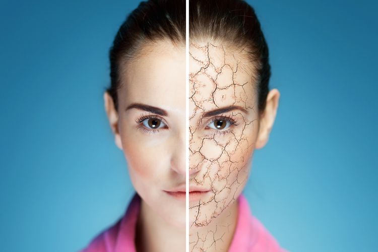 Ilustrasi kulit kering