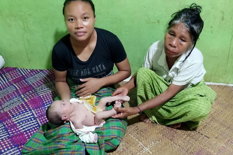Marselino Tasman bayi berusia 48 hari asal Desa Compang Cibal, Kecamatan Cibal Barat, Kabupaten Manggarai, Nusa Tenggara Timur (NTT) lahir tanpa lubang anus. 