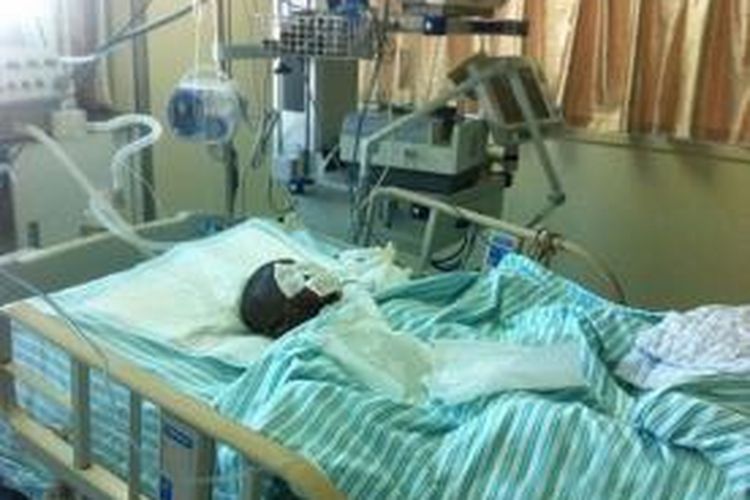 Duoduo (4) menderita luka bakar 35 persen terutama di bagian kepalanya setelah dibakar ibu kandungnya akibat merasa tak diperlakukan layak oleh suaminya.  Duoduo dirawat di ruang ICU sebuah rumah sakit di kota Jinhua, China.