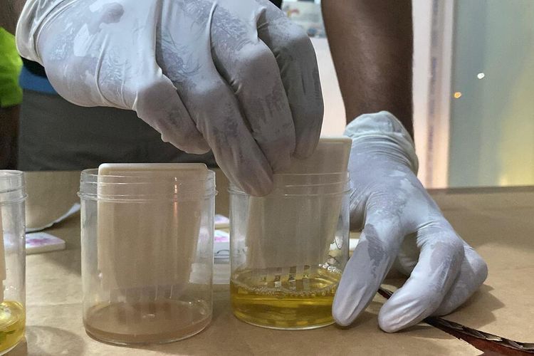 Tes Narkoba Pakai Urine Istri, Sopir Bus Ini Malah Dinyatakan Hamil
