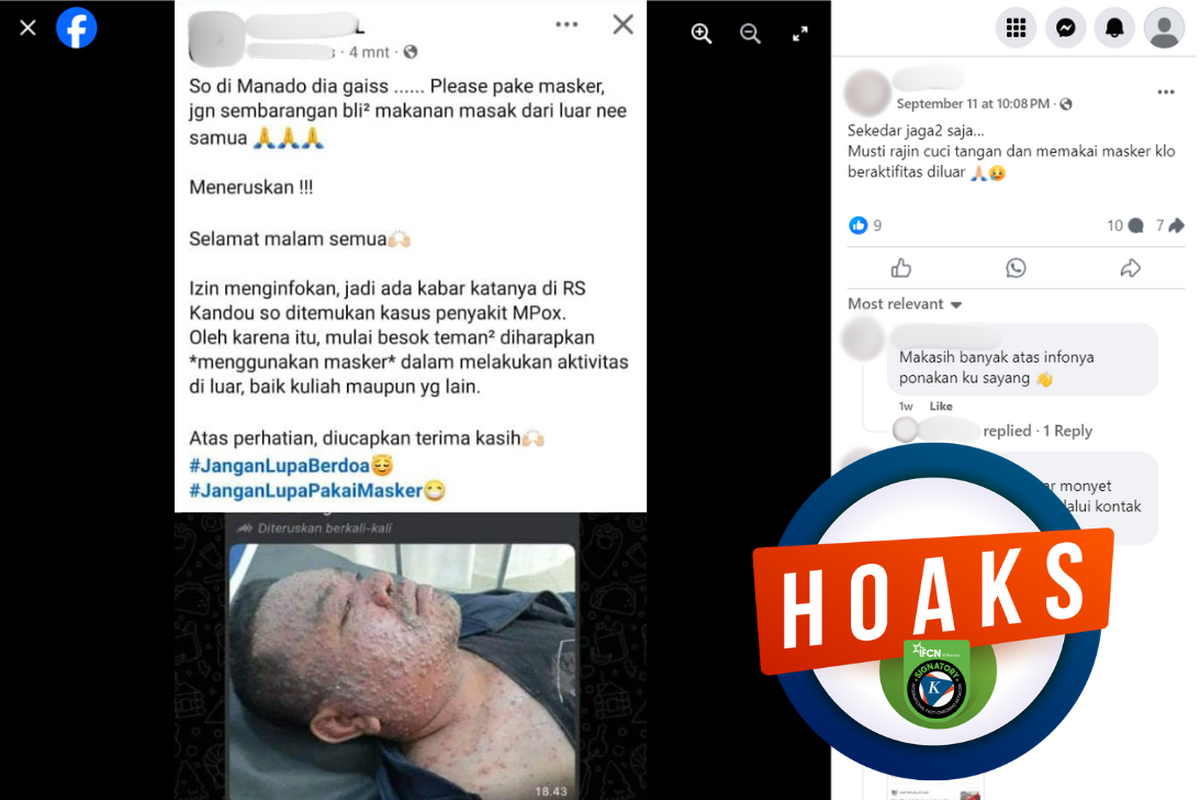 Tangkapan layar konten hoaks di sebuah akun Facebook, 11 September 2024, mengenai adanya kasus cacar monyet di RSUP Kandou, Manado.