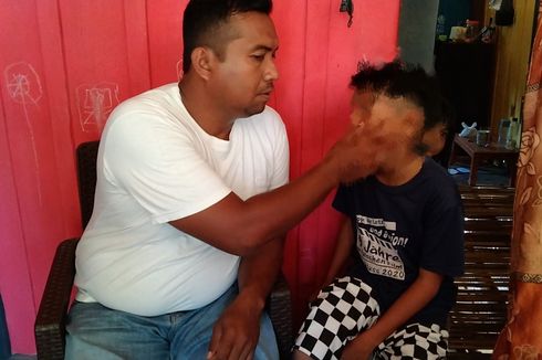 Siswa SMP di Buton Selatan Dipukul Guru hingga Giginya Copot karena Catatan Tidak Lengkap