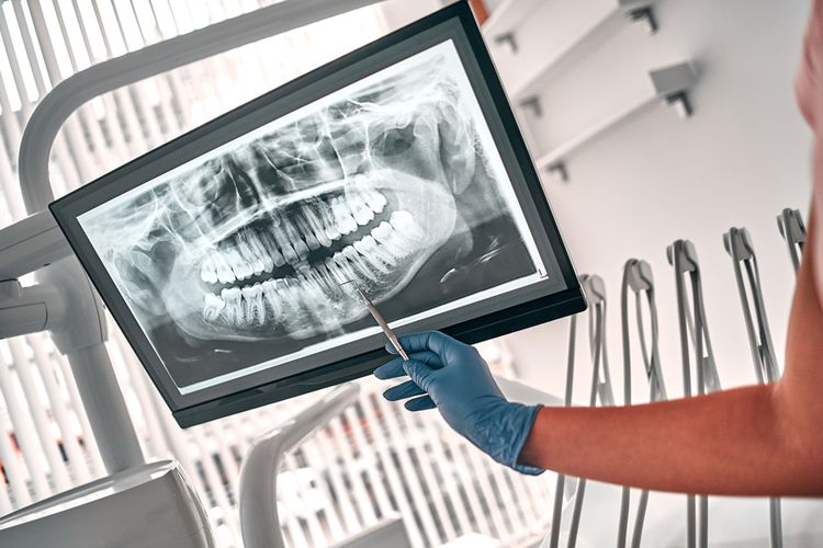 Ilustrasi dokter menunjukkan hasil rontgen gigi.