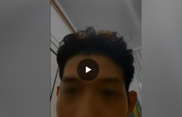 Dapat Telepon Nomor Luar Negeri, HP Pria Ini Diretas, Fotonya ...