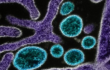 Penampakan partikel virus Nipah (biru) yang berada di pinggiran sel VERO yang terinfeksi (ungu). Gambar diambil dan ditingkatkan warnanya di NIAID Integrated Research Facility di Fort Detrick, Maryland. Penularan virus Nipah dari hewan ke manusia, dan 40 persen penularan dari manusia ke manusia.