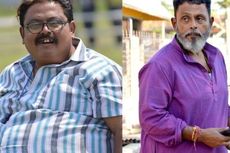Dulu Dikenal Berpenduduk Kurus-kurus, India Kini Hadapi Obesitas yang Menyebar Cepat