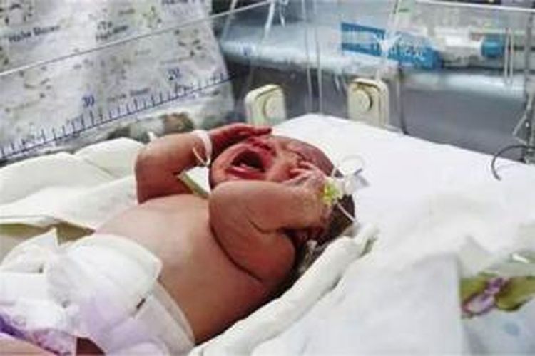 Bayi ini ditinggalkan dalam sebuah toilet sebuah pabrik di China, setelah dilahirkan ibunya yang masih remaja. Beruntung, bayi itu ditemukan dan langsung dibawa ke rumah sakit.