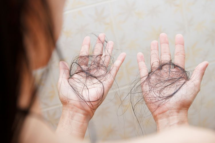 Rambut rontok perlu menjadi perhatian ketika helai rambut rontok per hari sudah mencapai lebih dari 100 helai dan sudah sangat mengganggu keseharian.
