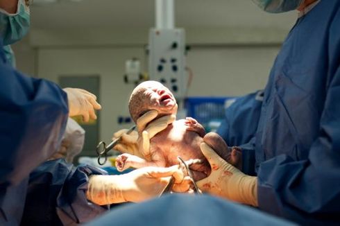 Menggenjot Kekebalan Tubuh Bayi yang Lahir Lewat Operasi