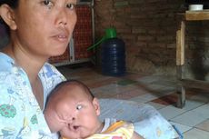 Bayi 2,5 Bulan di Bekasi Menderita Tumor di Wajah