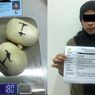 Detik-detik 2 Wanita Tepergok Bawa Sabu Senilai Rp 359 Juta di Dubur dan Selangkangan