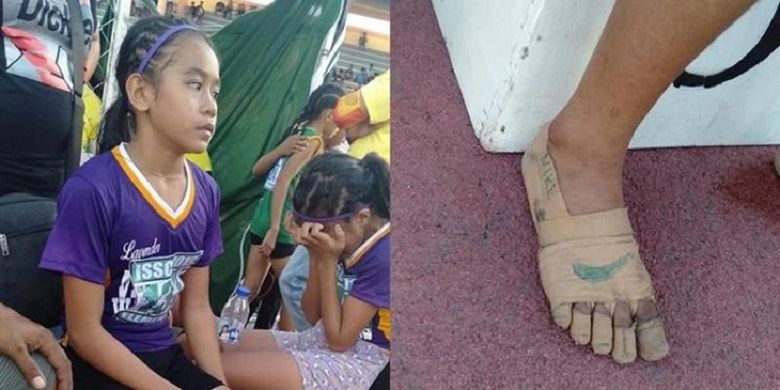 Atlet 11 tahun bernama Rhea Bullos ketika beristirahat, foto kanan adalah kakinya yang hanya dilapisi plester dengan gambar apparel olahraga Nike. Gadis itu menjadi viral setelah memenangkan 3 medali emas dengan kaki yang dilapisi plester.