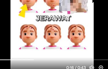 Tangkapan layar unggahan yang menyebutkan letak jerawat di wajah menunjukkan kondisi kesehatan.