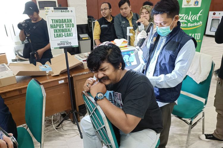 Lutfi (27), salah satu peserta kegiatan hapus tato yang berlangsung di Kantor Wali Kota Jakarta Timur pada Selasa (4/4/2023).