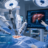 Pertama di Dunia, Dokter Arab Saudi Sukses Operasi Hati dengan Robot dan Sayatan Super Kecil