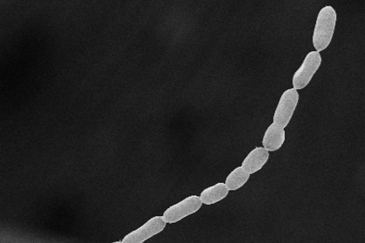 Gambar bakteri terbesar di dunia bernama Thiomargarita magnifica dirilis oleh Lawrence Berkeley National Laboratory pada 23 Juni 2022. Bakteri terbesar di dunia berukuran 2 cm ini ditemukan di hutan bakau Guadeloupe, Perancis.