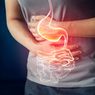 Gastritis Disebabkan oleh Apa? Ini Penjelasannya...