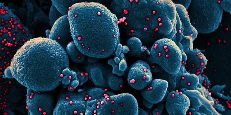 Gambar selebaran tanpa tanggal yang diambil dan ditingkatkan warnanya di National Institute of Allergy and Infectious Diseases (NIAID) Fasilitas Riset Terpadu (IRF) di Fort Detrick, Maryland, AS dan yang disediakan oleh National Institutes of Health (NIH) menunjukkan warna pemindaian mikrograf elektron dari sel apoptosis (biru) yang terinfeksi partikel virus SARS-COV-2 (merah), diisolasi dari sampel pasien (dikeluarkan 24 Maret 2020). EPA-EFE/NIAID/NATIONAL INSTITUTES OF HEALTH HANDOUT  HANDOUT EDITORIAL USE ONLY/NO SALES