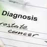 3 Cara Mencegah Kanker Prostat pada Pria