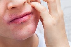 6 Penyebab Bibir Kering dan Gatal yang Perlu Diketahui