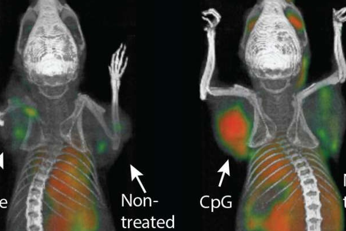 tumor pada tikus berhasil dihilangkan dengan sistem imun