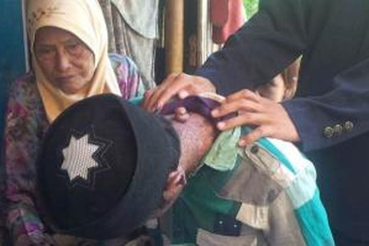 Cepi Wahdan diduga menderita kanker kulit stadium lanjut. Kini Cepi hidup di sebuah gubuk bersama delapan saudaranya di Kampung Cimahi, Desa Pasir Jambu, Kecamatan Maniis, Kabupaten Purwakarta. 
