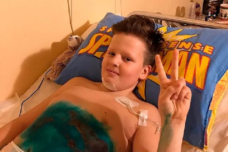 Arkady Aksenov ketika dirawat di rumah sakit di Rusia. Bocah 11 tahun itu harus kehilangan dua kakinya setelah dilindas kereta karena melakukan aksi berbahaya.