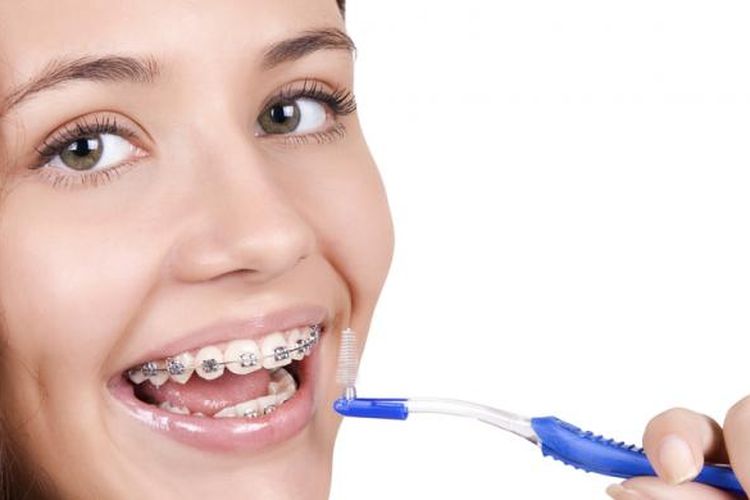 Ilustrasi perawatan gigi.