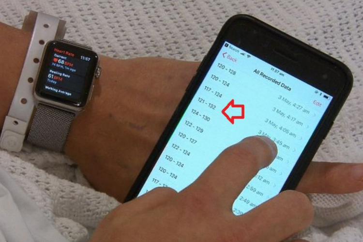 Apple Watch selamatkan nyawa orang.