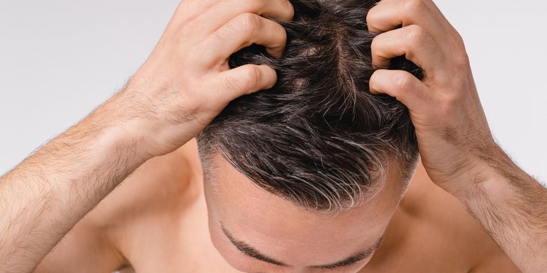 5 Pemicu Rasa Gatal Di Kulit Kepala Halaman All Kompas Com
