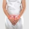 4 Penyebab Kista Vagina sesuai Jenisnya