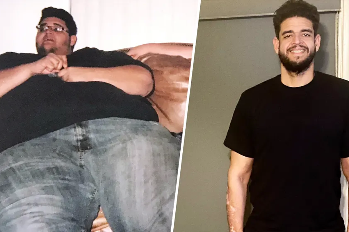 Beau Griffin sebelum dan sesudah perjalanan penurunan berat badan. Lelaki 39 tahun ini pernah mencapai berat lebih dari 320 kilogram pada suatu ketika.  