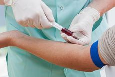 7 Hal Mengejutkan yang Bisa Dilihat Dokter dari Hasil Tes Darah