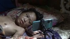 Kisah Zulkifli di Polewali Mandar: Digigit Anjing Saat SMP, Terbaring Sakit Bertahun-tahun, Ibunya Bertahan dengan Mencari Kelapa