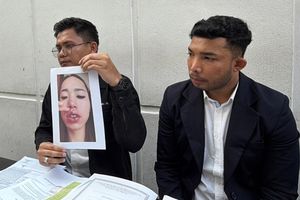 Finalis Puteri Indonesia Buka Klinik Bermodal Sertifikat, Pasien Alami Luka dan Cacat Permanen