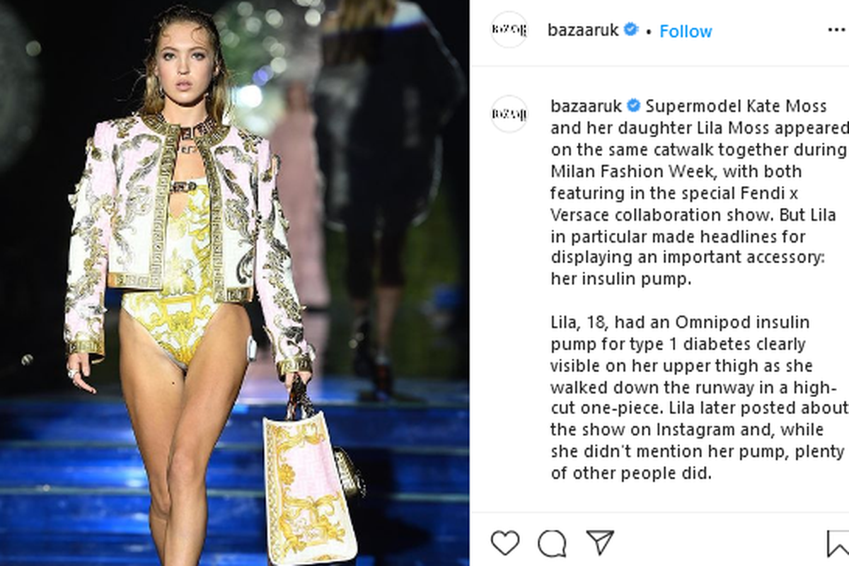 Lila Moss, model yang adalah anak dari supermodel Kate Moss sedang berjalan di runaway peragaan busana Fendi x Versace, di Milan Fashion Week, lengkap dengan pompa insulin melekat di pinggulnya. 